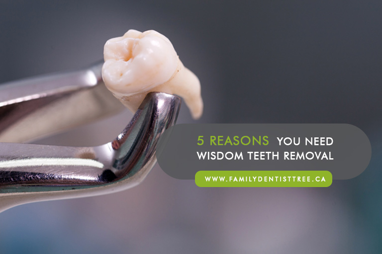 5-Reasons-You-Need-Wisdom-Teeth-Removal