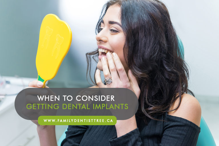 When to Consider Getting Dental Implants